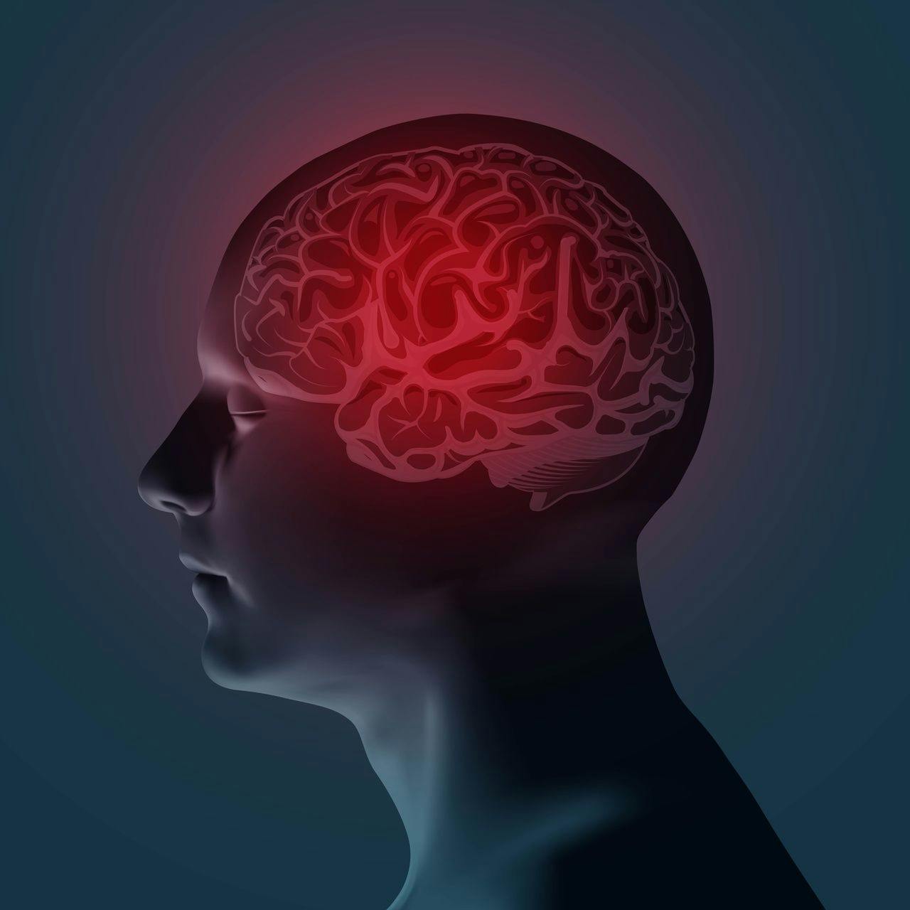 Population-Based Study Identifies Numerous Risk Factors for Migraine