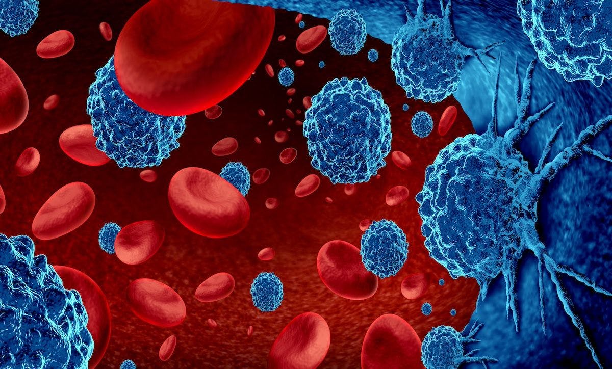 Enhanced image of leukemia | Image Credit: © freshidea - stock.adobe.com
