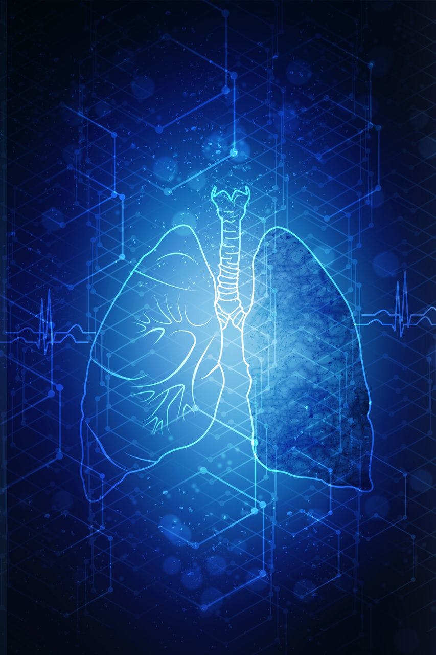 Analyzing Changes in Frailty Among Patients With COPD