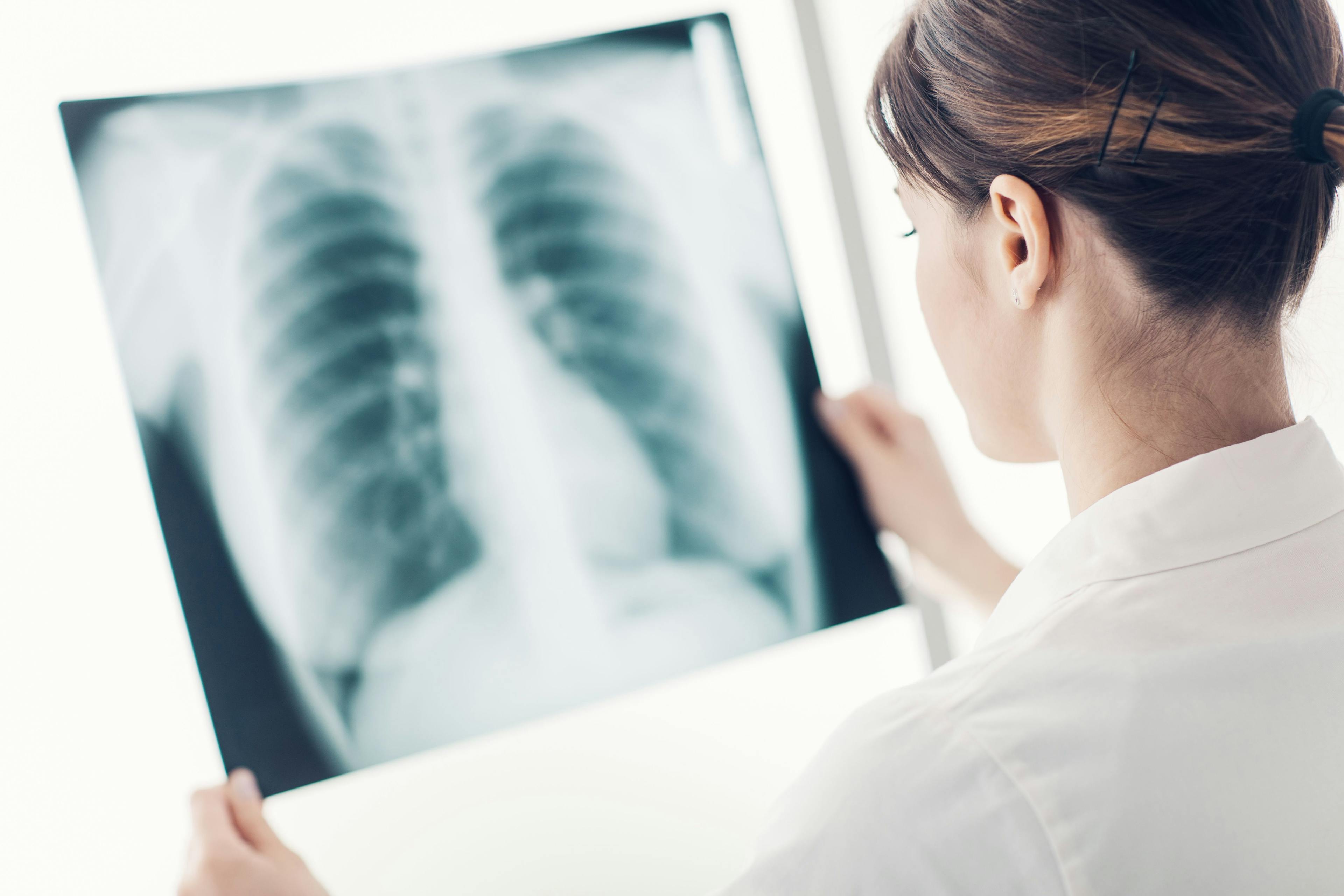Doctor examining a patient's x-ray - StockPhotoPro - stock.adobe.com