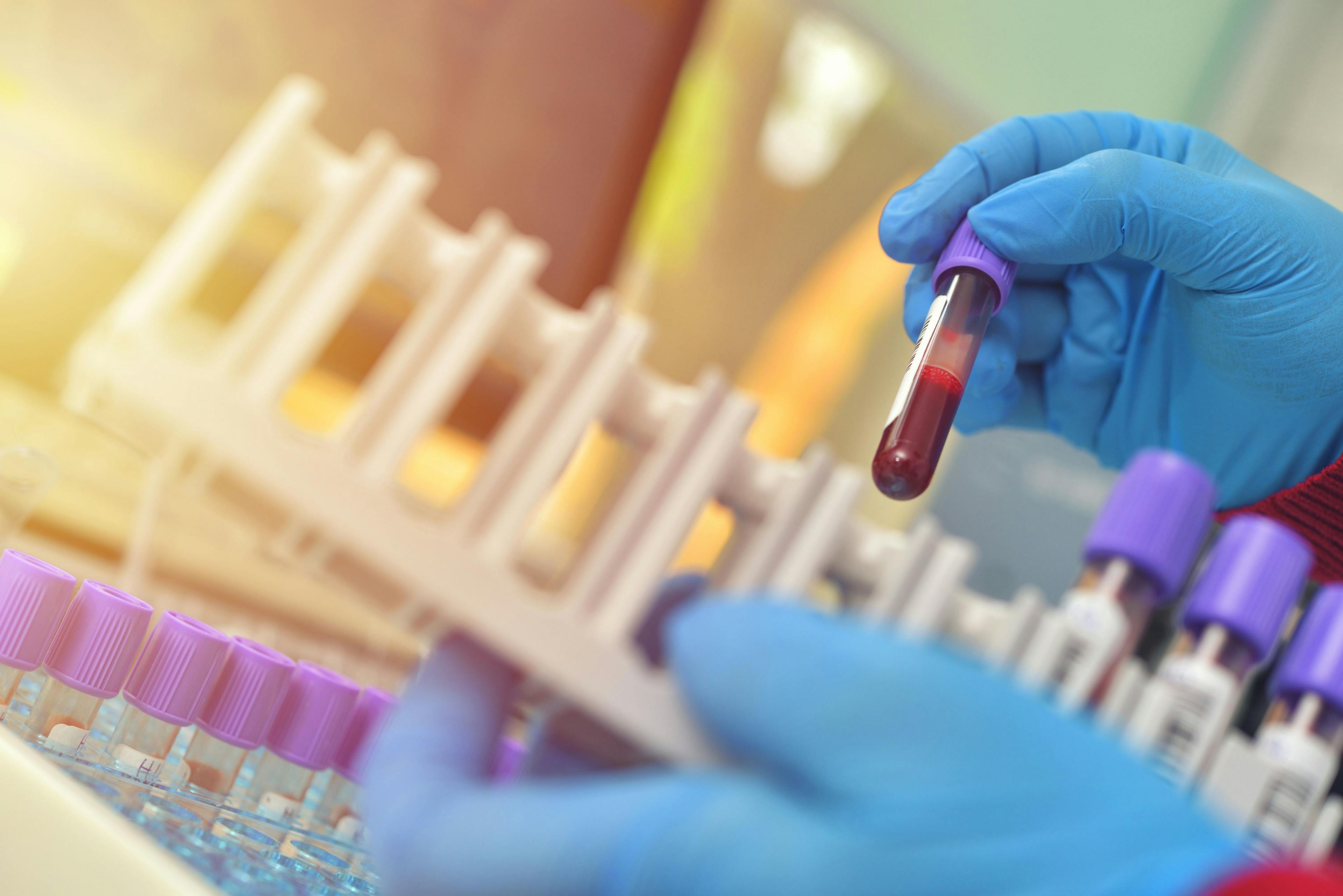 Blood samples | Image credit: © Daniel CHETRONI – stock.adobe.com