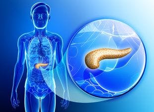 Severe Neutropenia May Predict Survival Outcomes in Patients With Pancreatic Cancer
