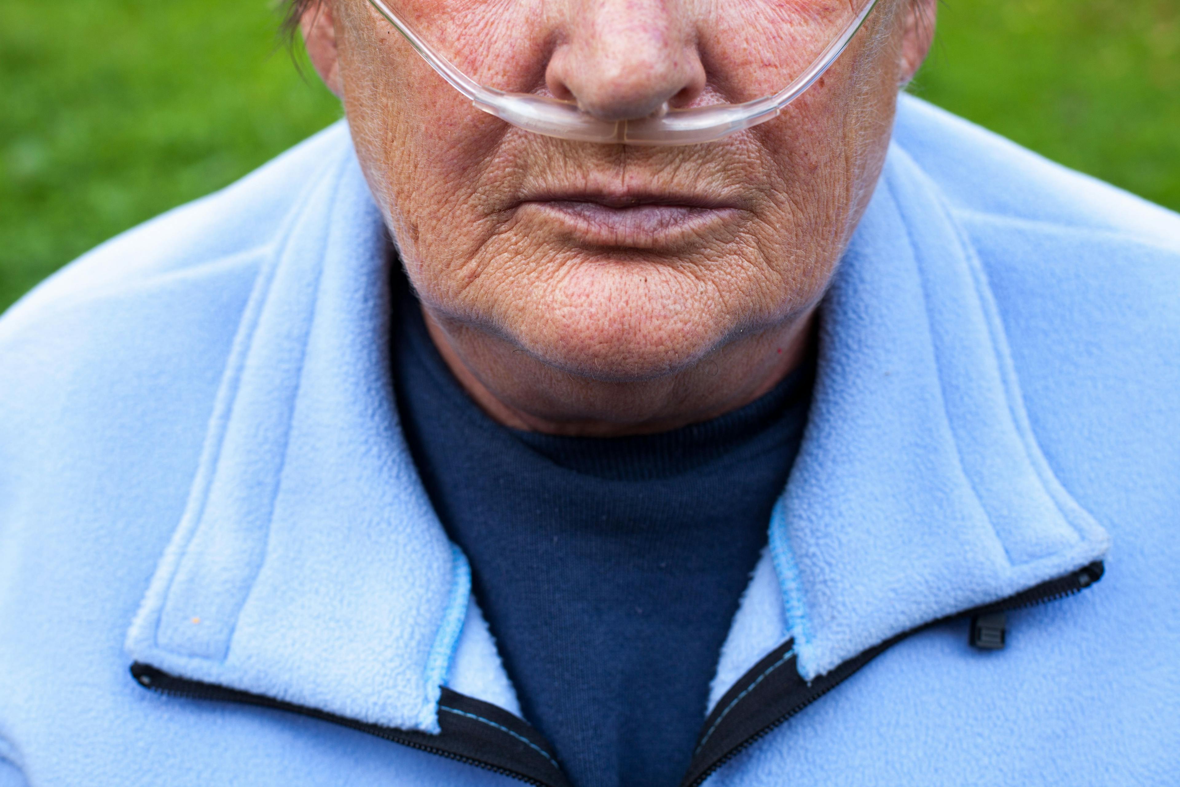 senior man with nose tubes for oxygen intake