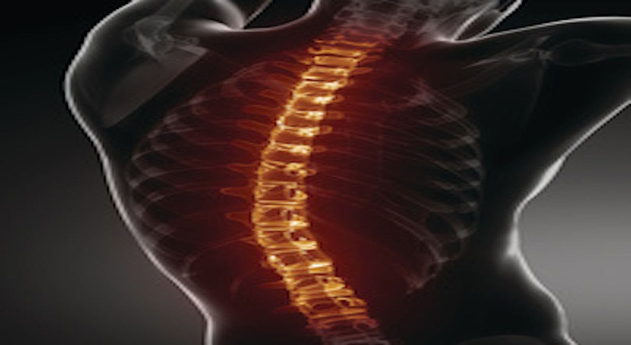 Highlighted image of the spine