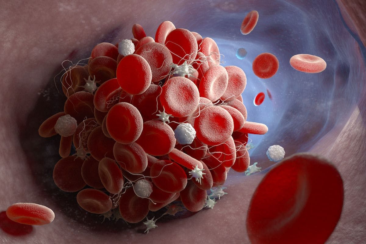 Formation of a blood clot | image credit: © Tatiana Shepeleva - stock.adobe.com