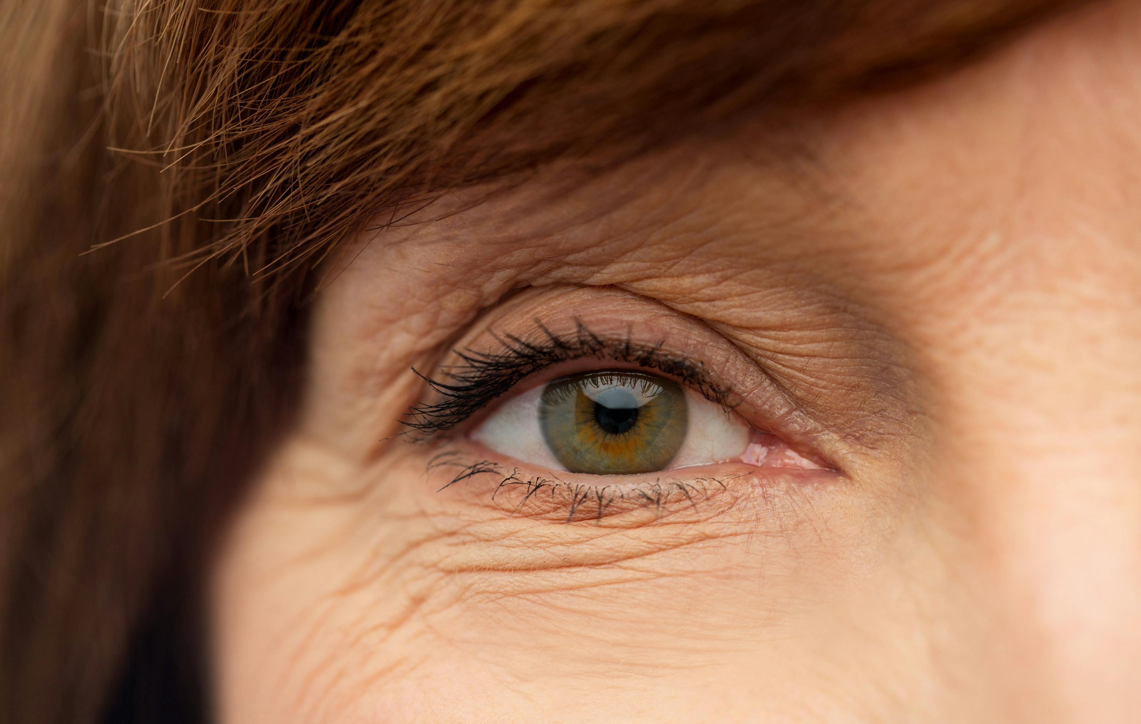 Eye of senior woman | Image credit: Syda Productions - stock.adobe.com