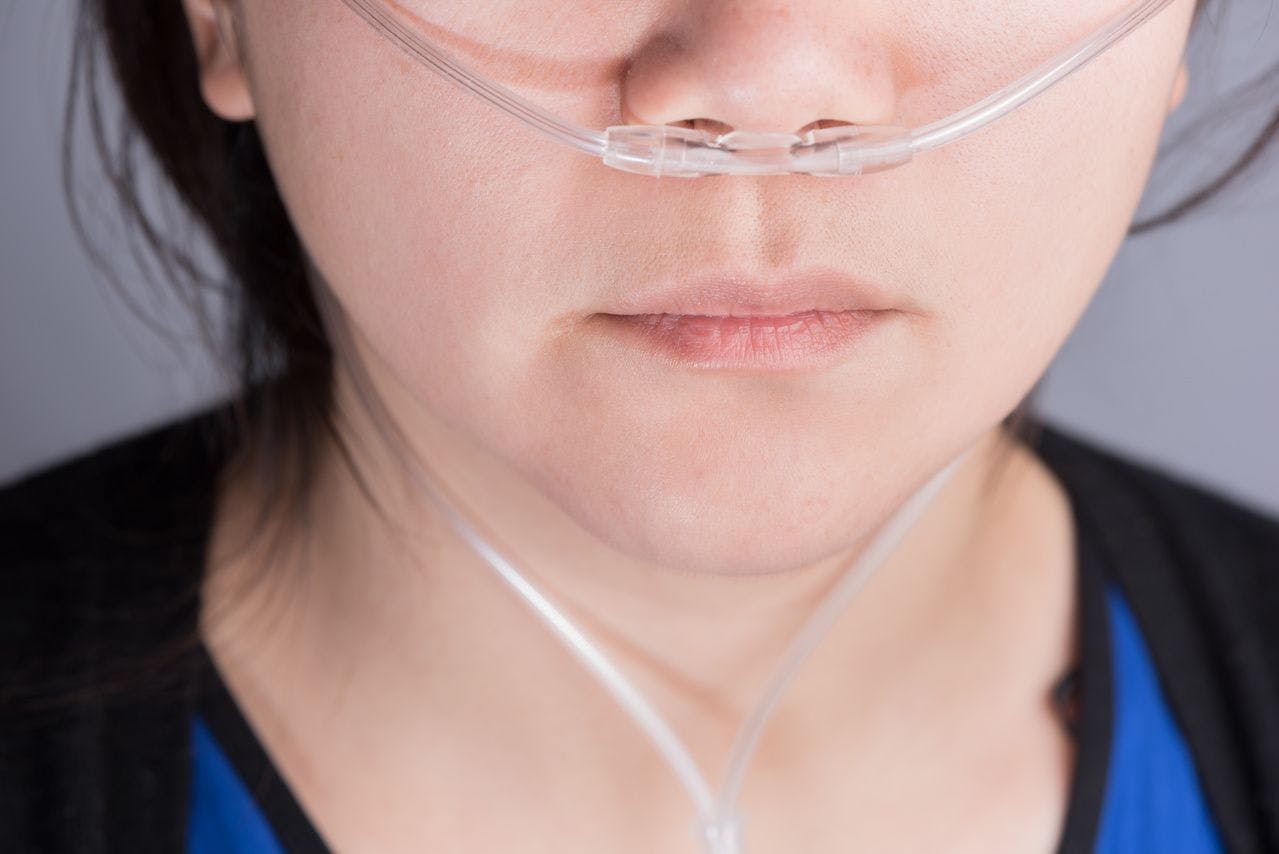 Study Investigates the Role of Peak Oxygen Pulse in Patients With COPD