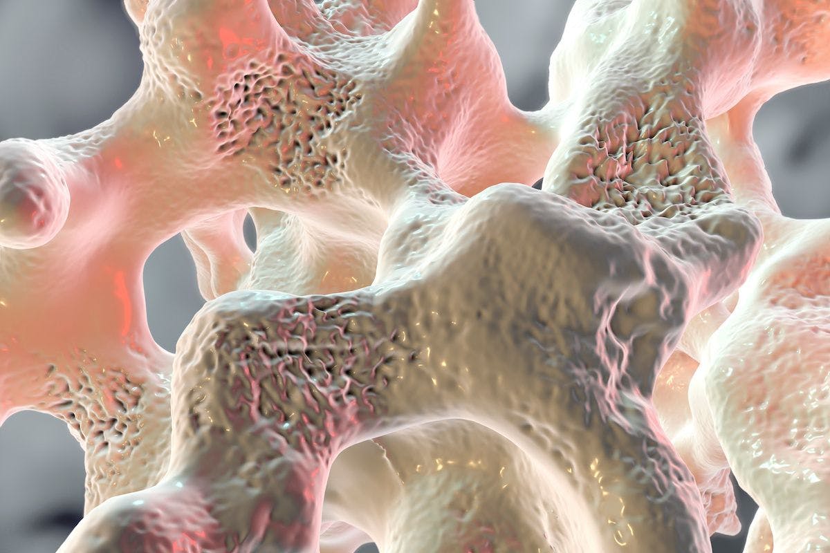 Spongy bone tissue affected by osteoporosis, 3D illustration | Image Credit: © Dr_Microbe - stock.adobe.com