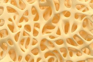 Pfenex Reports Good Results of Biosimilar for Osteoporosis