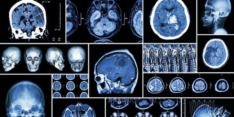 brain scan graphic