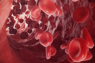 Daily Bleed Diaries of Patients With Hemophilia A Show Surprisingly High Number of Untreated Bleeds 