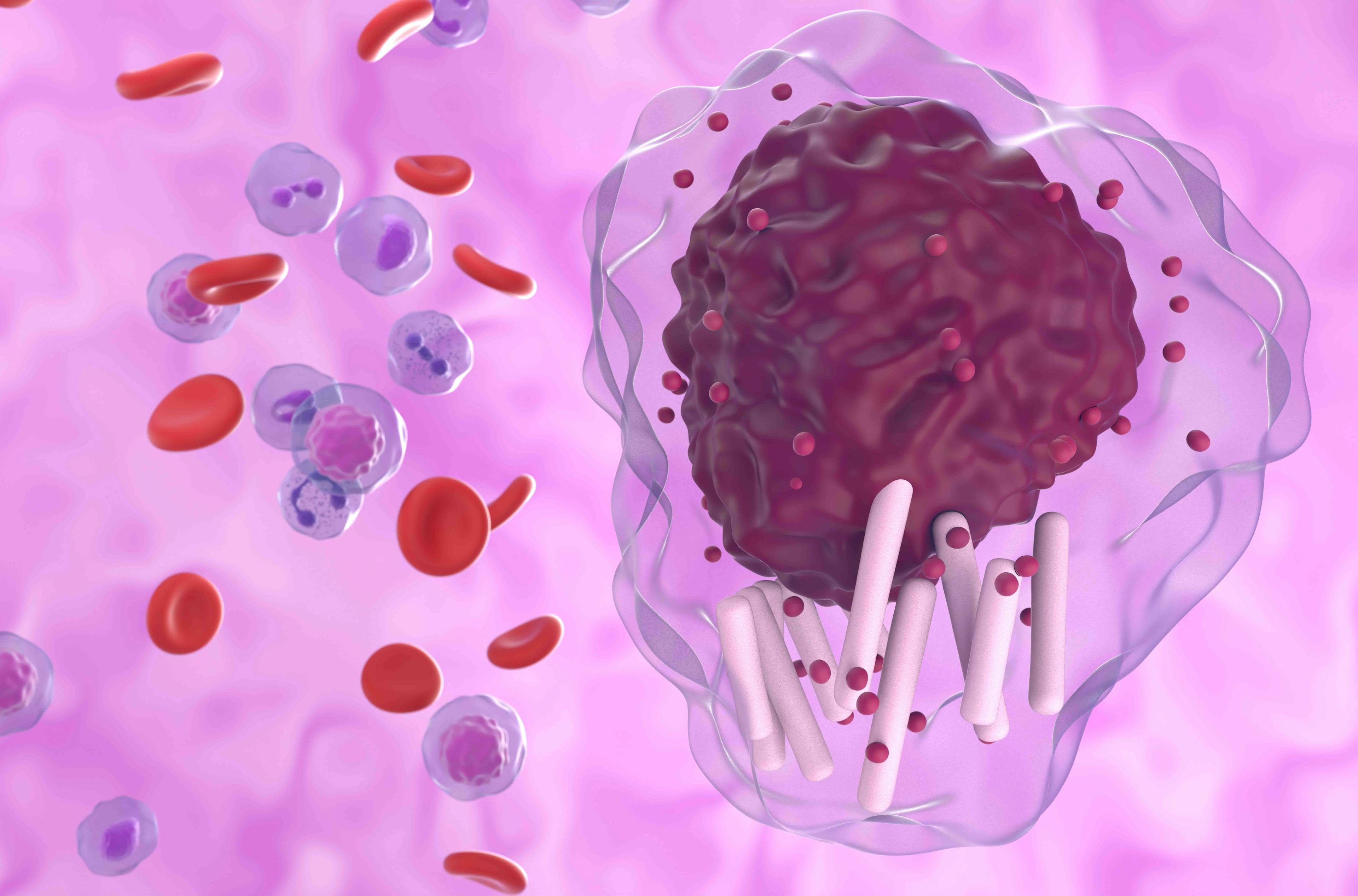 Chronic lymphocytic leukemia in blood | Image credit: LASZLO - stock.adobe.com