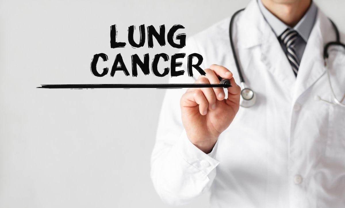 Lung cancer in black marker | Image Credit: MPStudio - stock.adobe.com