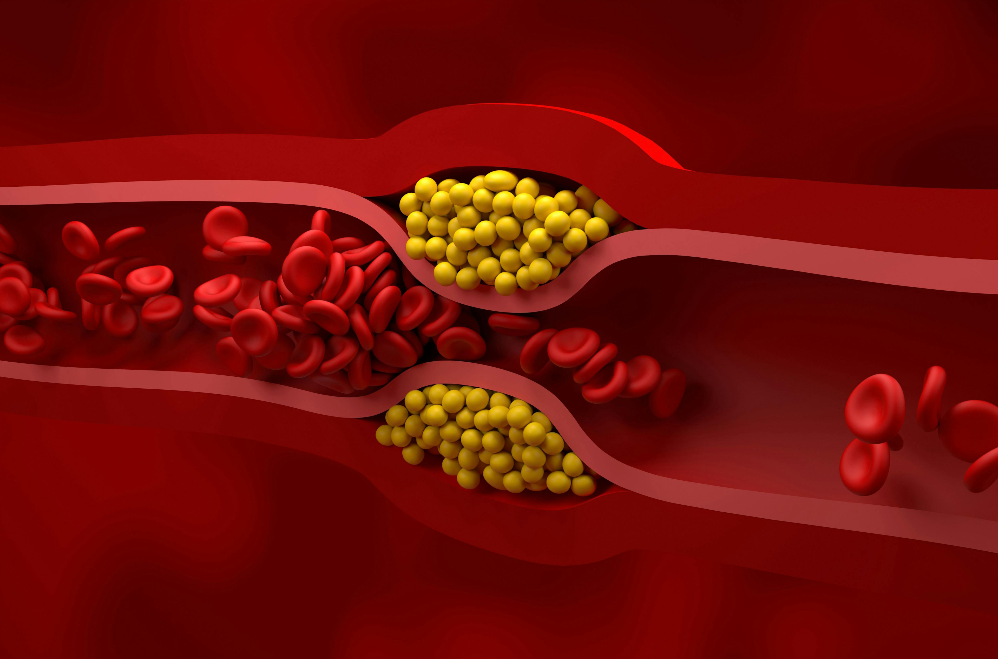 Low-density lipoprotein cholesterol | Image credit: LASZLO – stock.adobe.com
