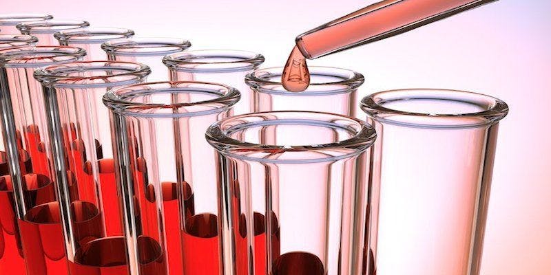Image of blood in test tubes