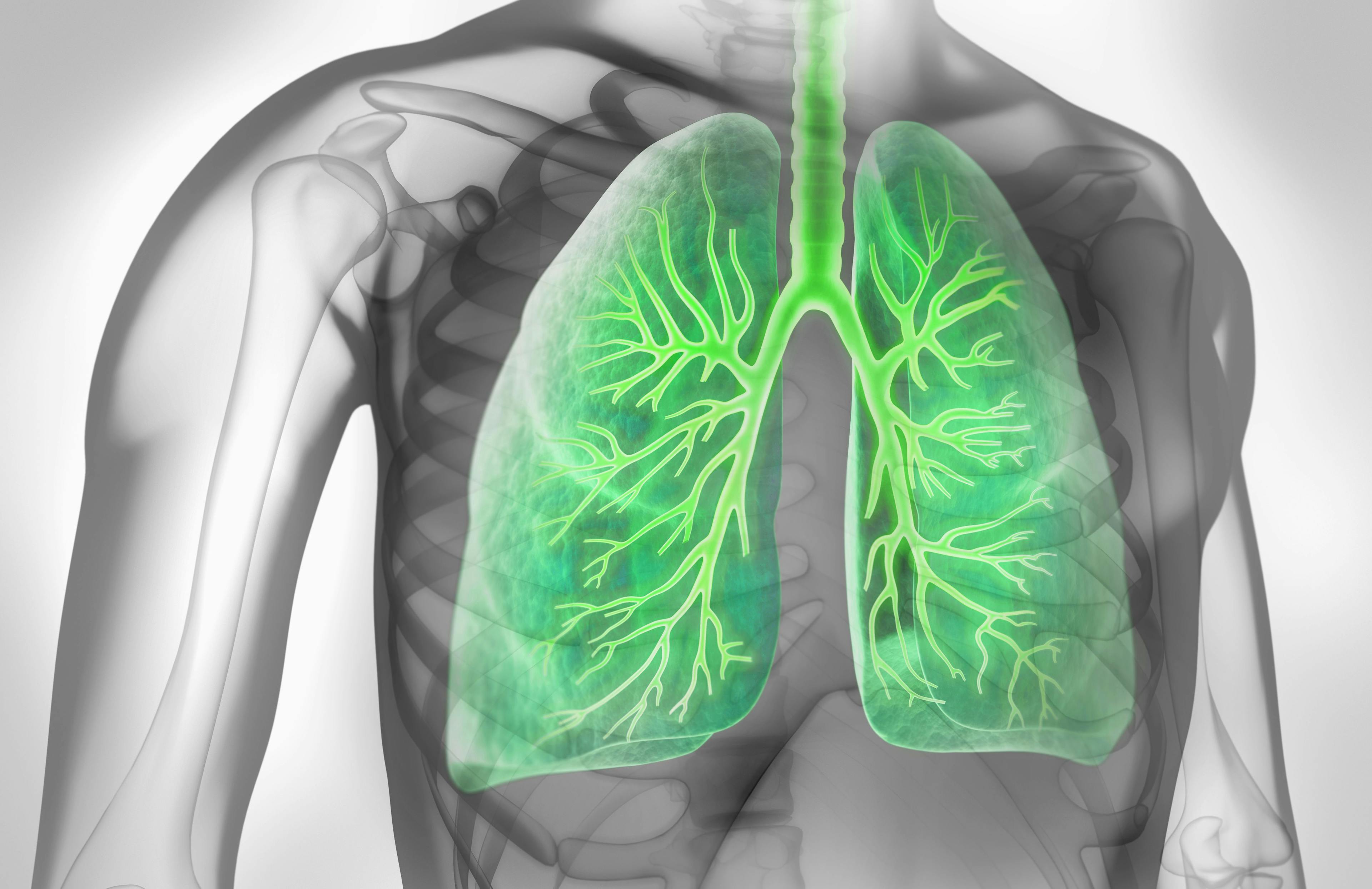 Graphic of lung