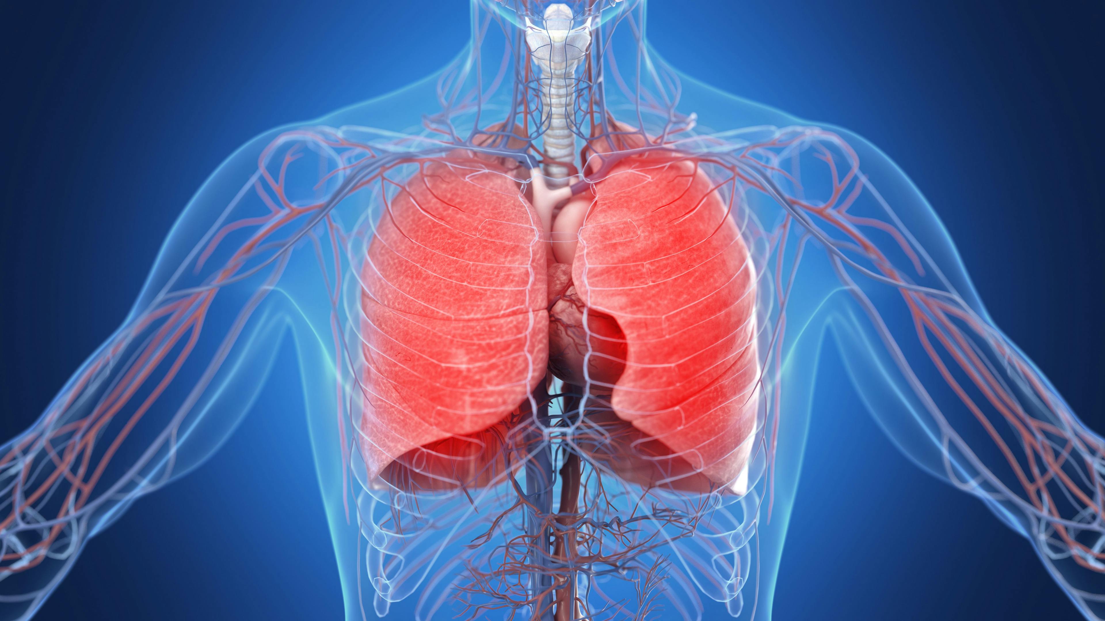 Inflamed lungs | Image credit: SciePro - stock.adobe.com