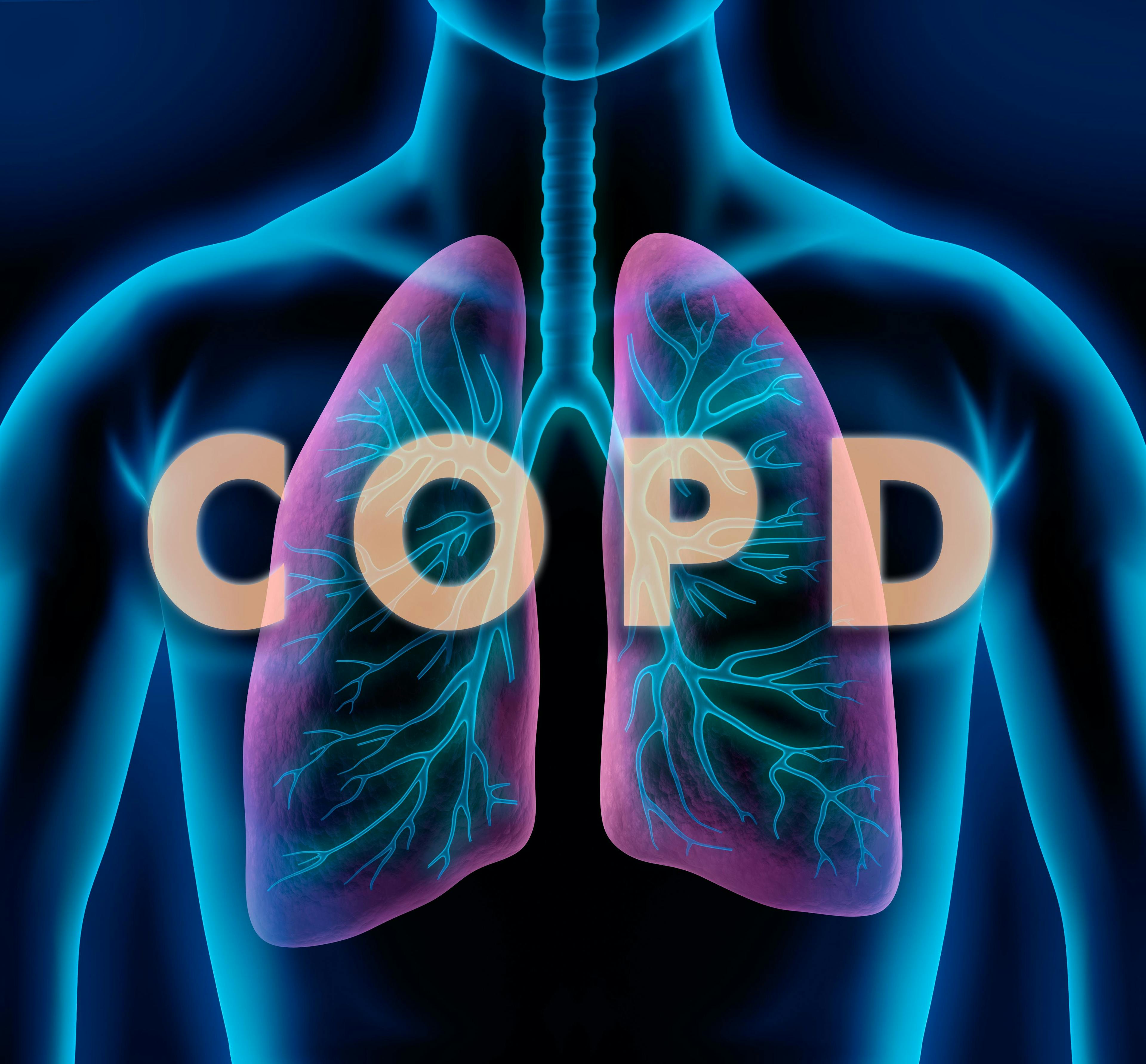 COPD animation | Image Credit: peterschreiber.media - stock.adobe.com