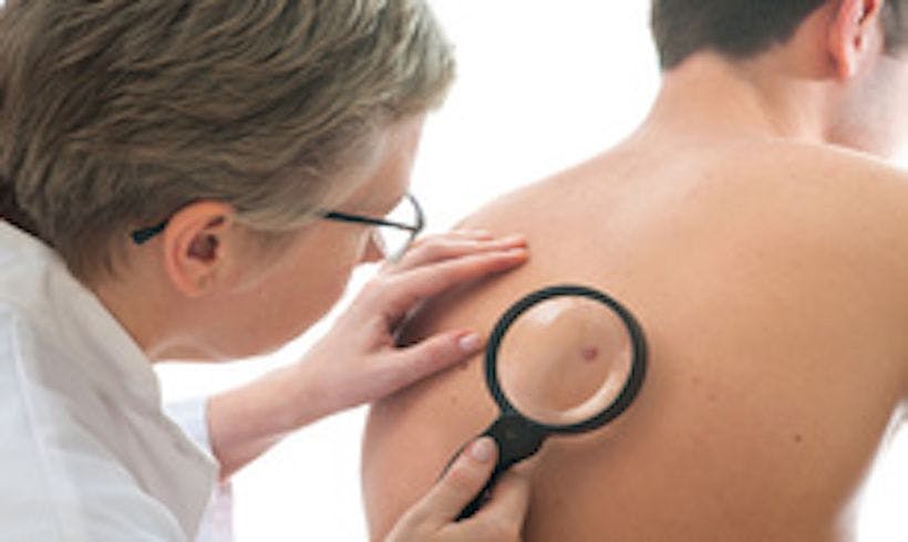 Image of a skin exam