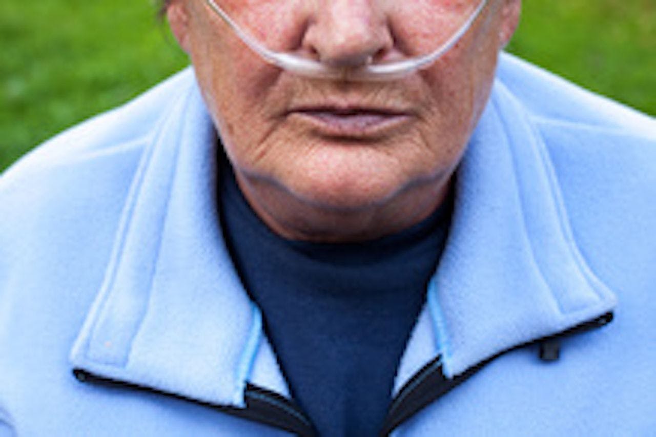 man with nasal cannula