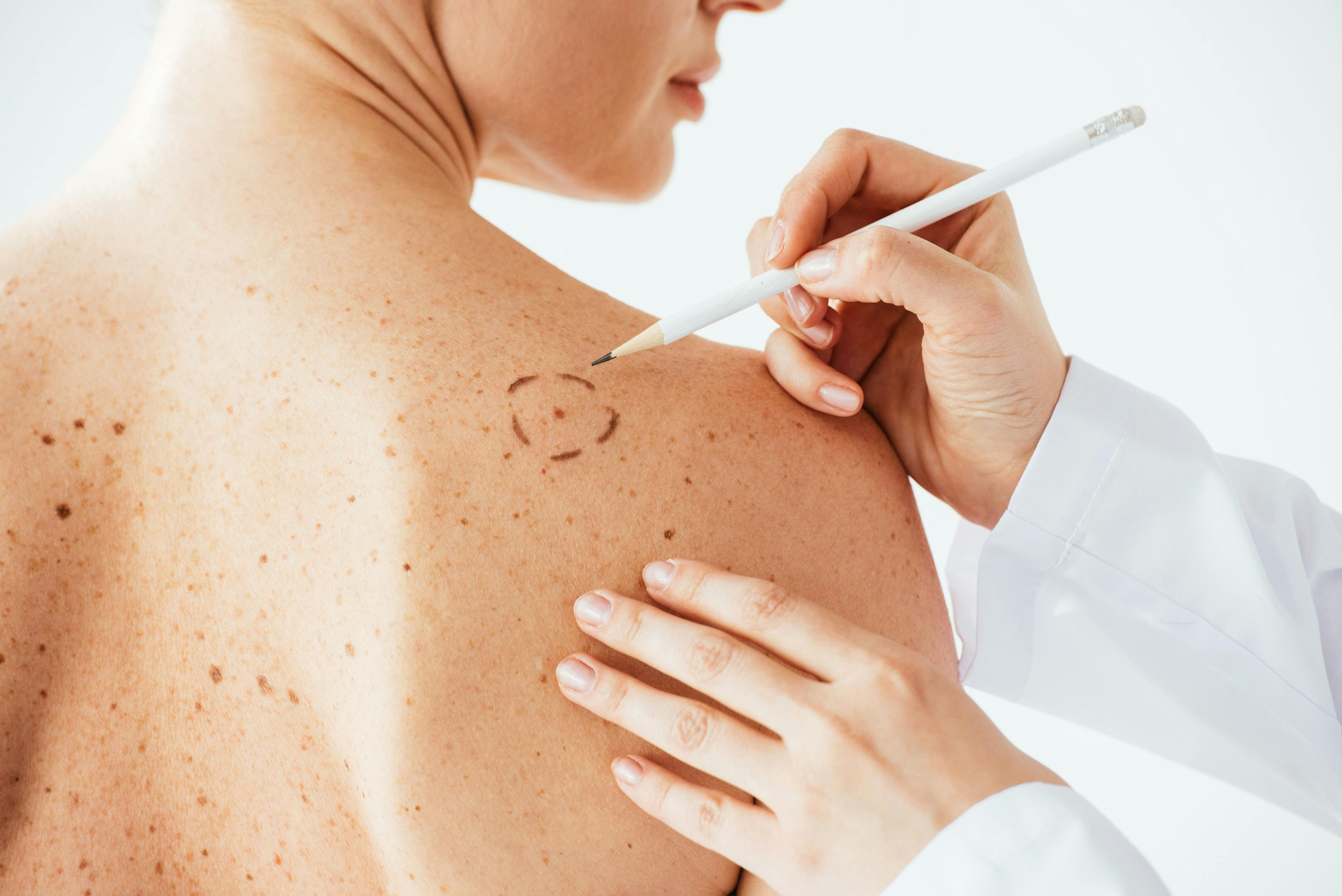 dermatology exam | Image credit: LIGHTFIELD STUDIOS - stock.adobe.com
