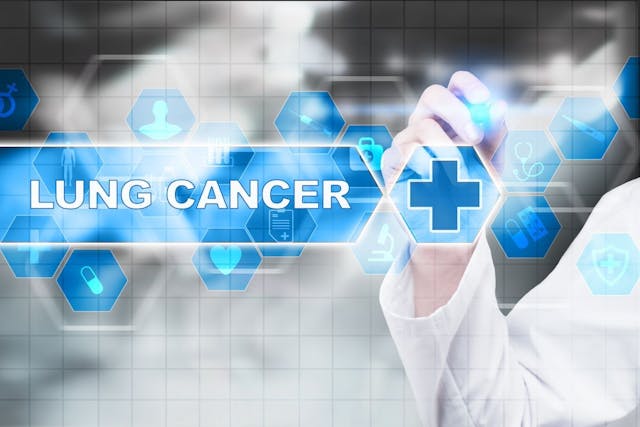 Lung cancer | Image Credit: WrightStudio-stock.adobe.com