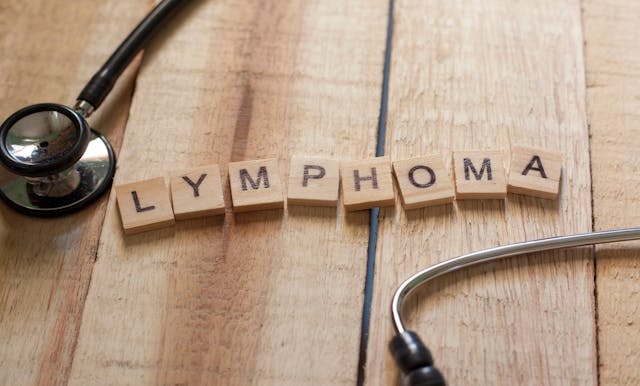Lymphoma word block image | Image Credit: © airdone - stock.adobe.com