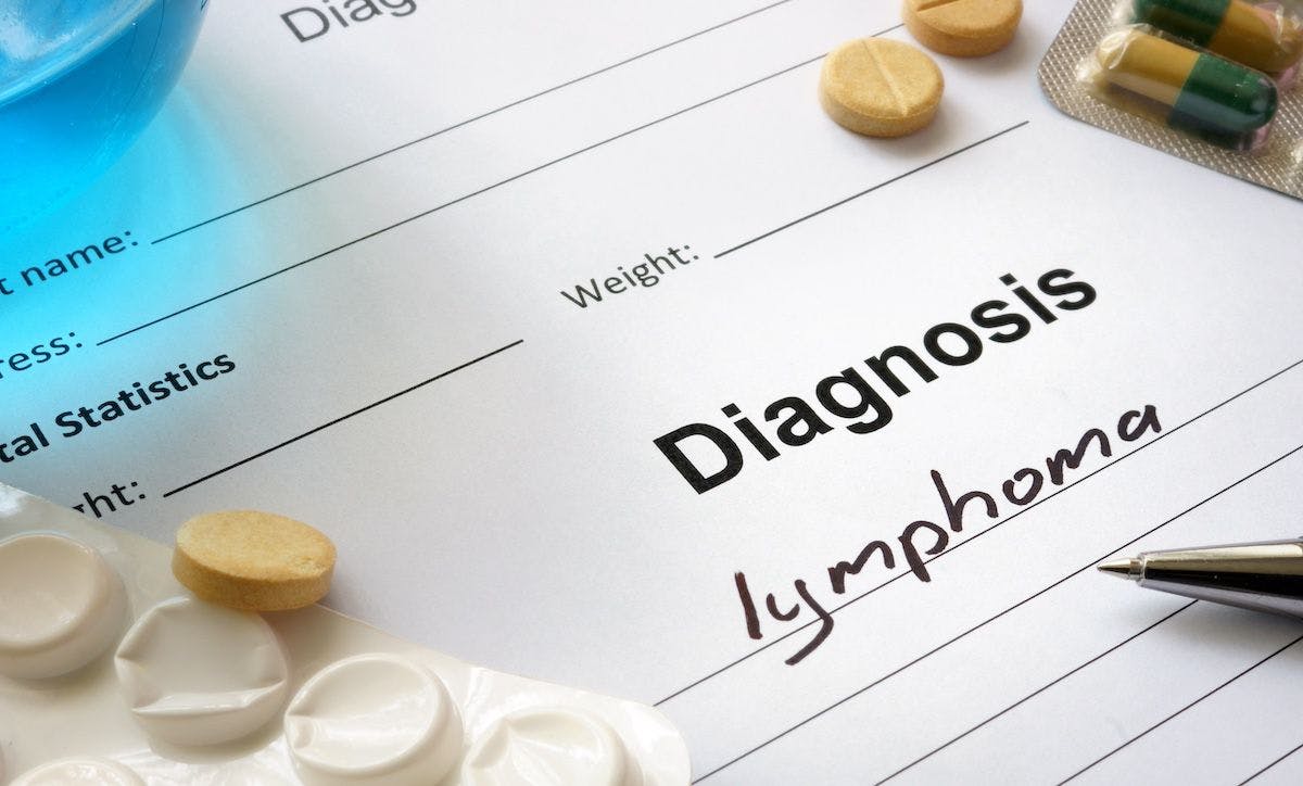 Lymphoma diagnosis | Image Credit: © Vitalii Vodolazskyi - stock.adobe.com