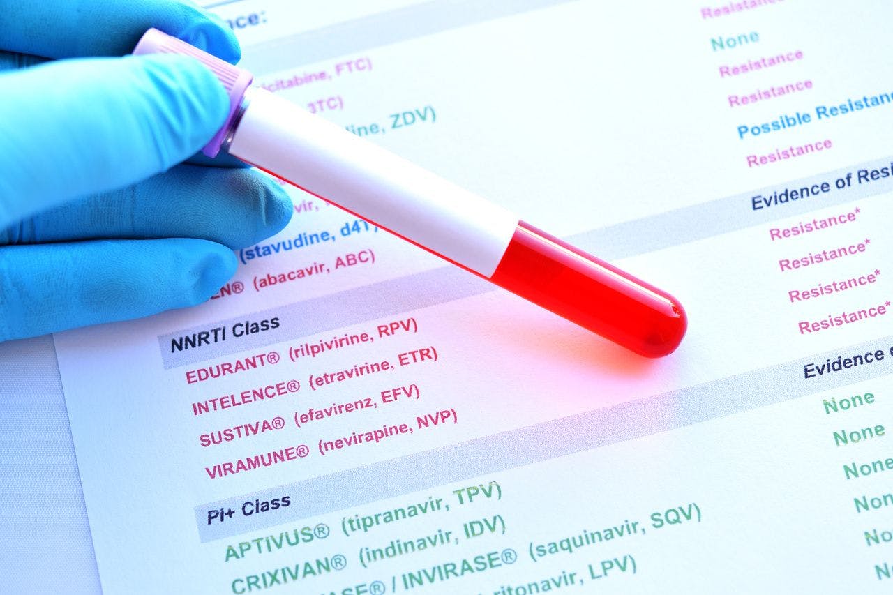 Study Results Recommend Ongoing, but Updated, HIV-1/HIV-2 Differentiation Testing