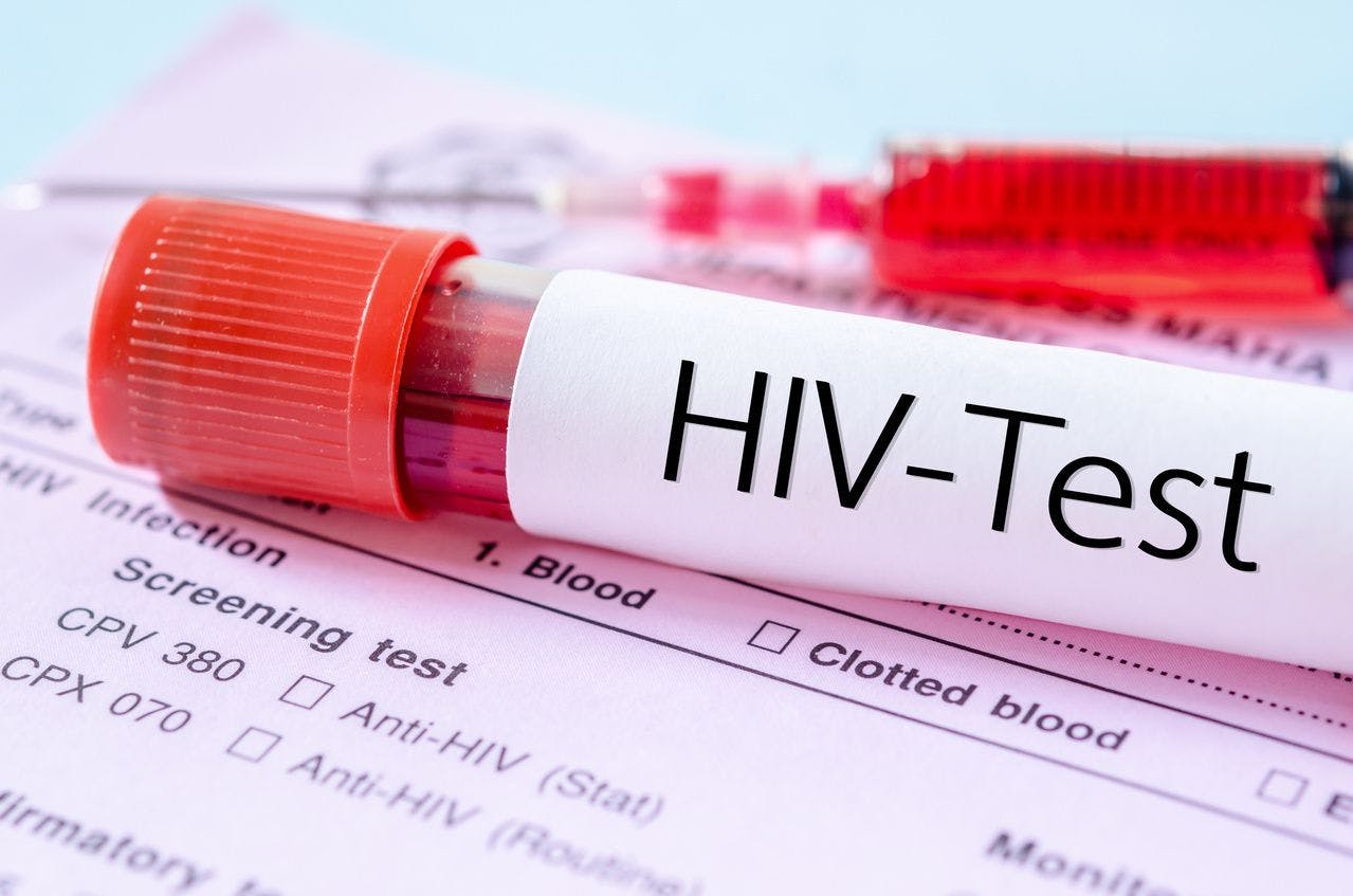 Initiating Treatment in EDs Could Be Critical for Containing Spread of HIV