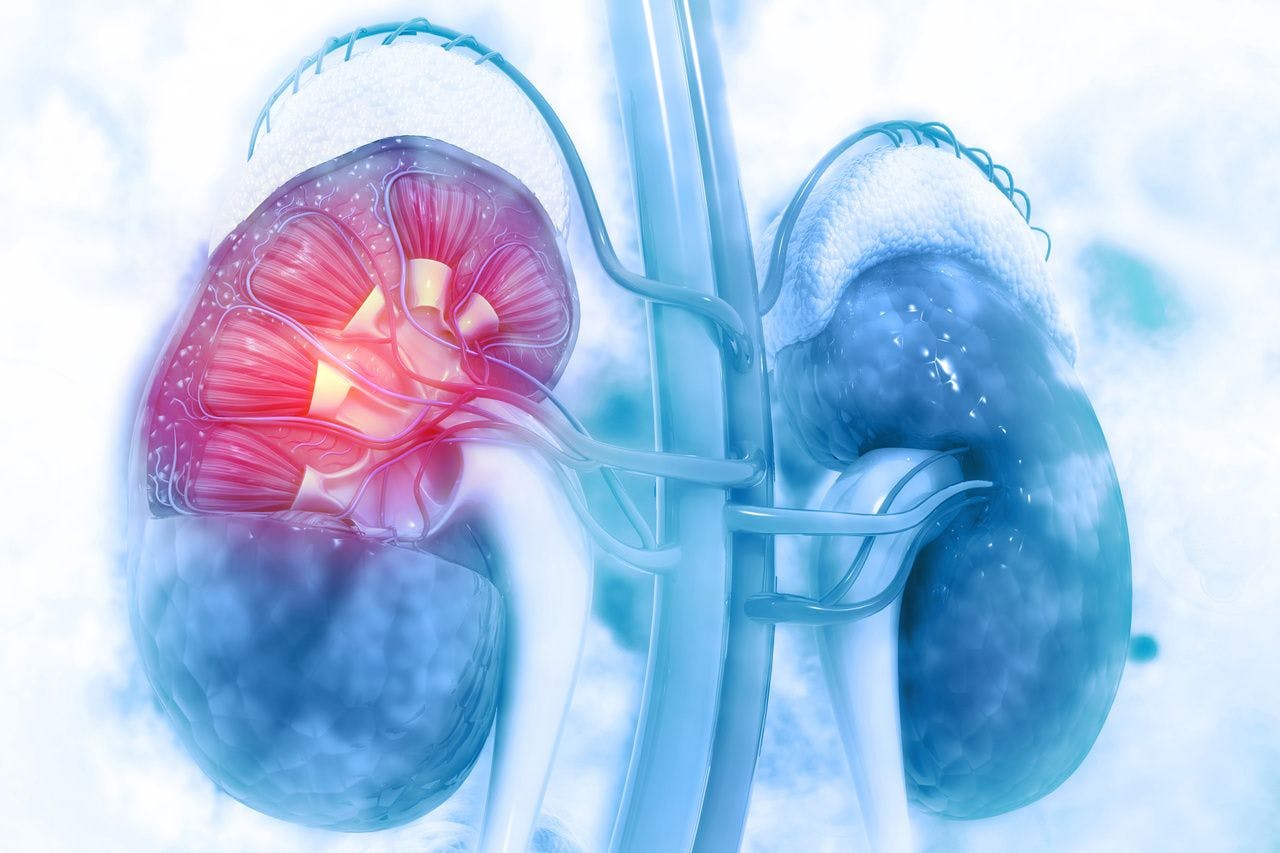 Late-Stage Trial for Dapagliflozin Ends Early After Showing Efficacy for Chronic Kidney Disease