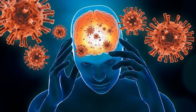 Infections Altering Brain, Sleep Disorder Concept | image credit: Matthieu - stock.adobe.com