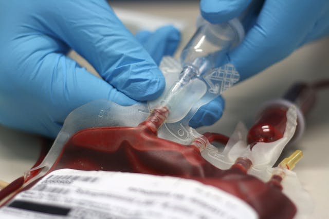 Blood for Transfusion PNH Concept | image credit: sebgross - stock.adobe.com