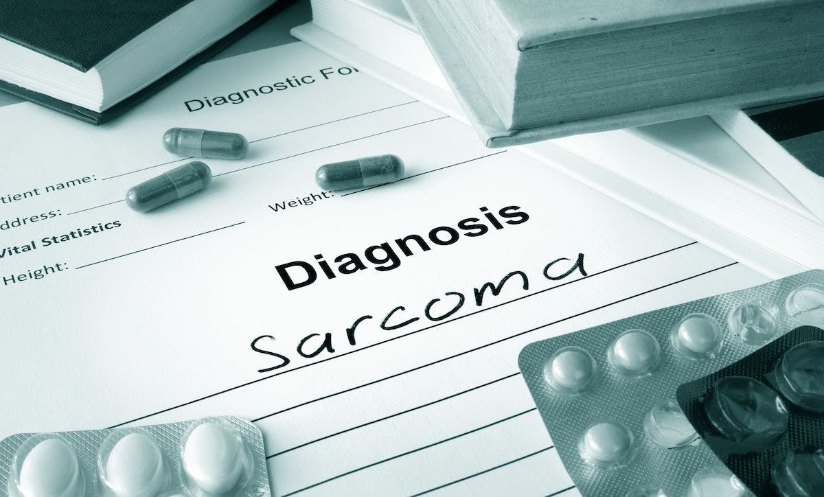 Sarcoma diagnosis | Image Credit: VitaliiVodolazskyi-stock.adobe.com