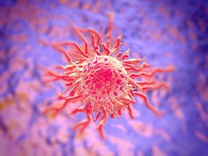 Nivolumab, Ipilimumab Combo Yields Clinically Meaningful Responses in Advanced Hepatocellular Carcinoma