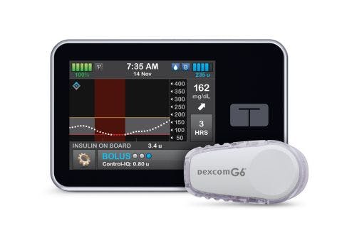 Tandem Gets FDA Clearance for Insulin Pump System With Novel Automated Dosing Feature