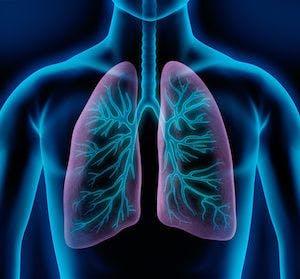 Study Examines Bronchiectasis in COPD