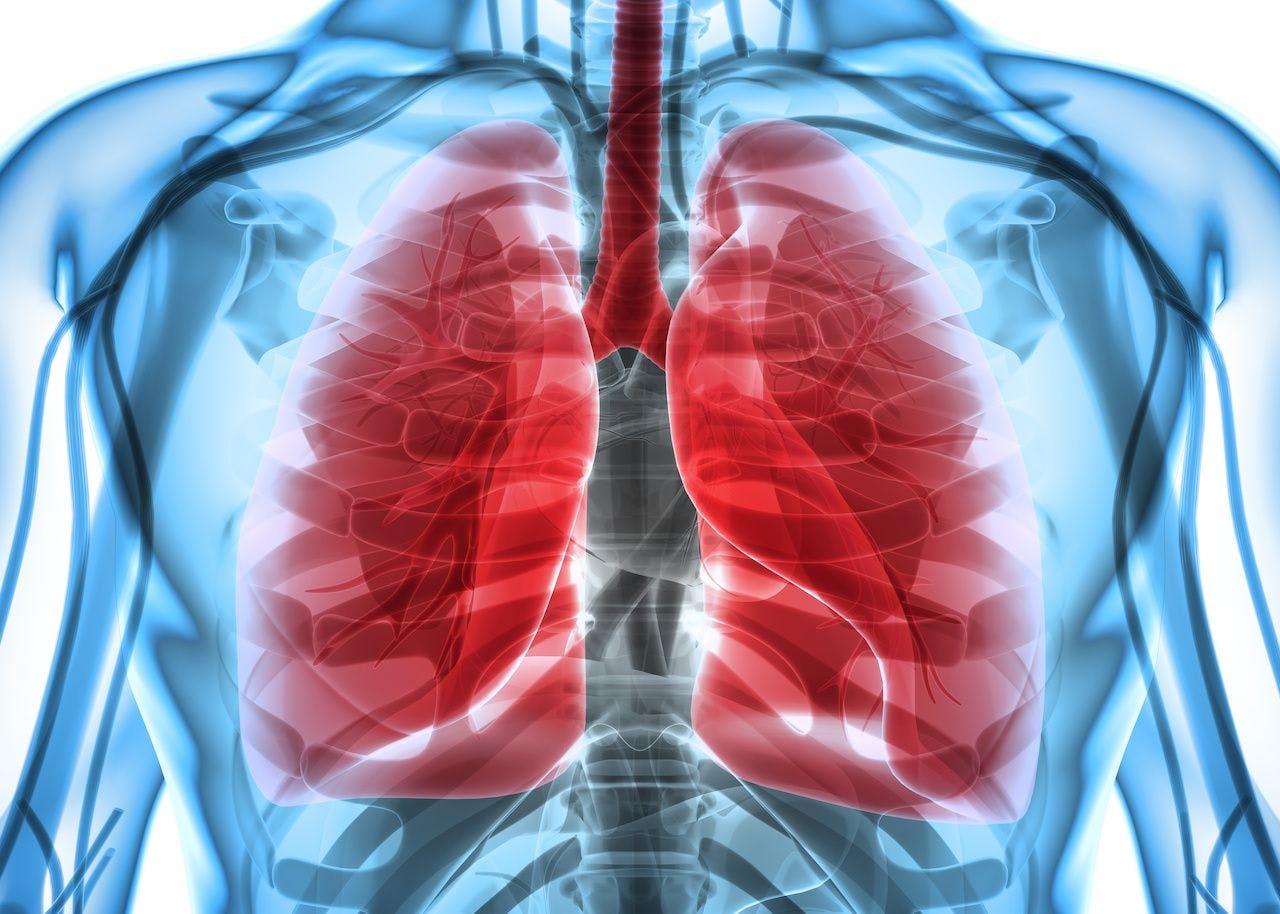 Most Patients With CF May Get Insufficient Antibiotics to Fight Lung Infections