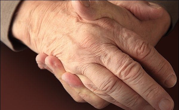 Older person hands.