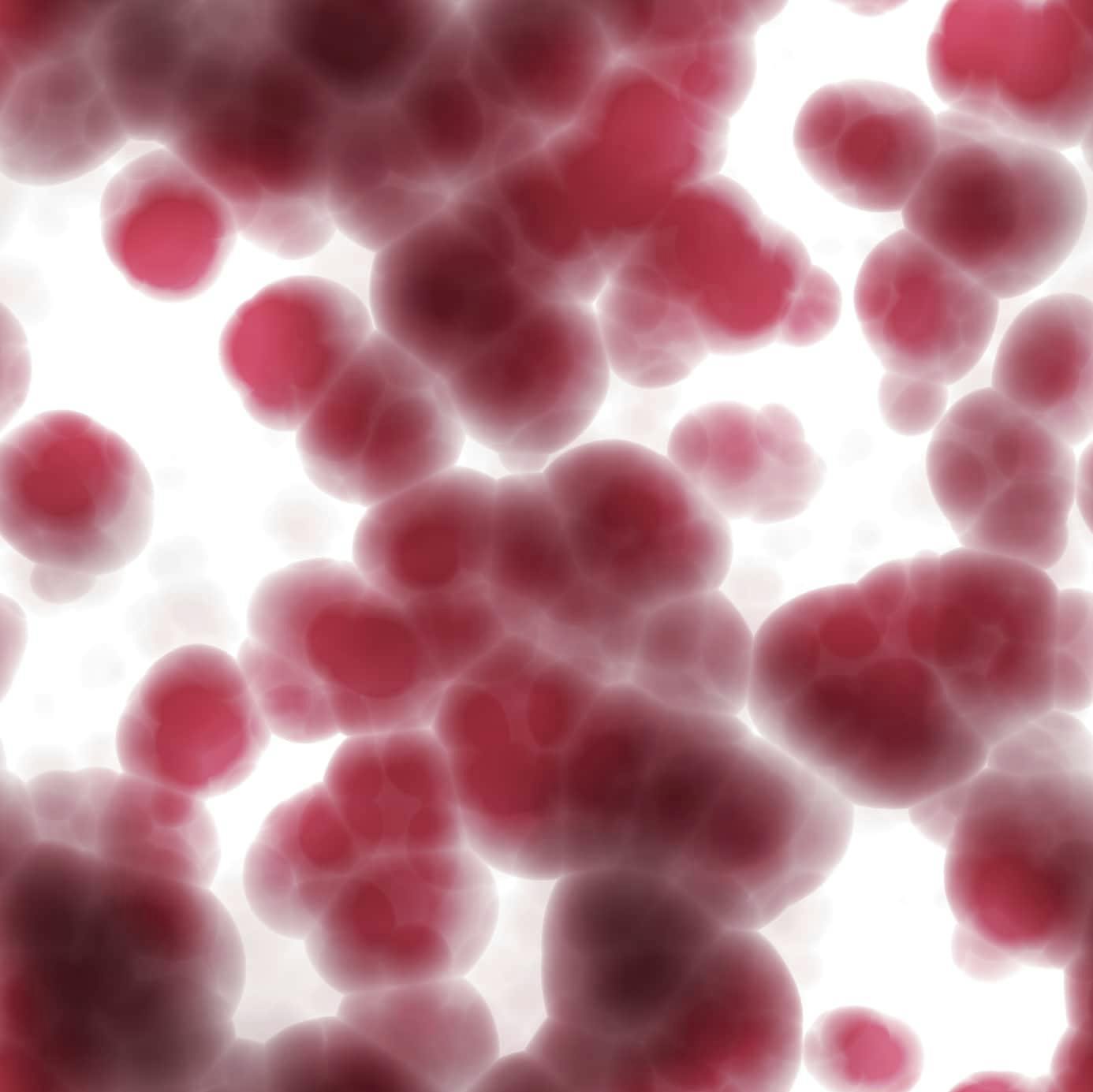 Axi-Cel Highly Effective as First-line Option in High-risk Large B-Cell Lymphoma