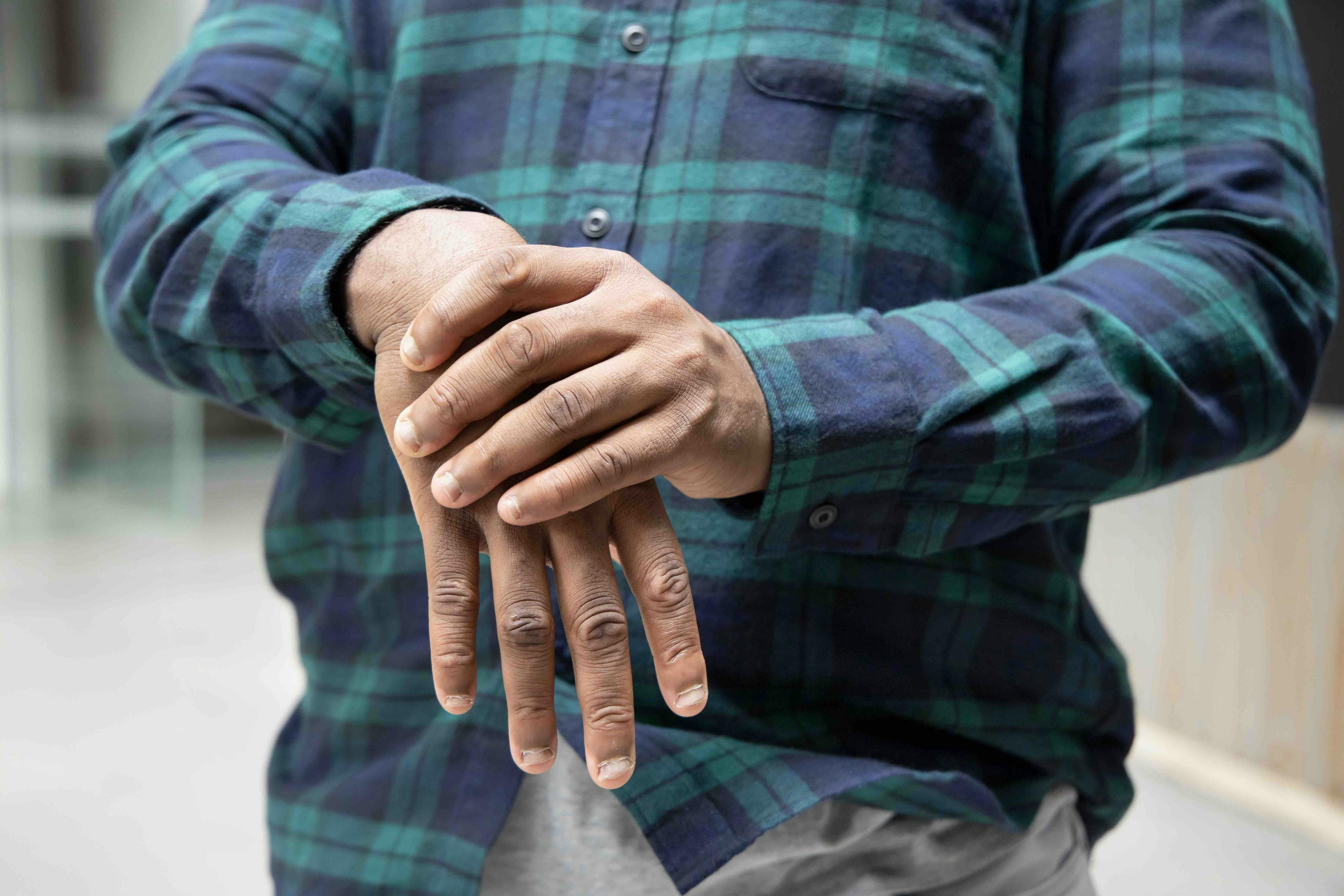Black patient with arthritis | Image credit: 9nong - stock.adobe.com
