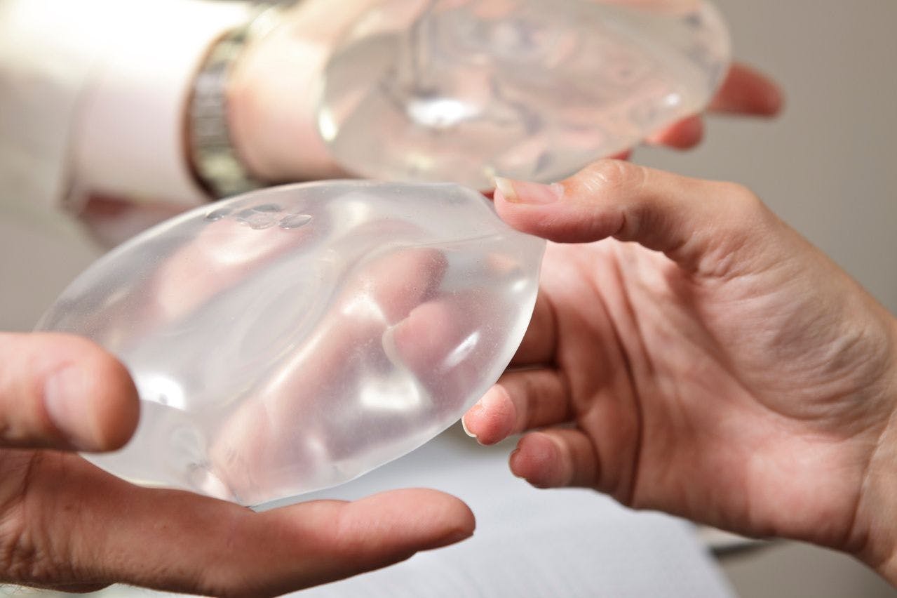 Is Prepectoral Breast Implant Reconstruction After Mastectomy Safe?