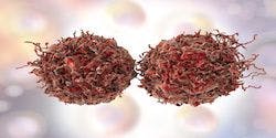 ICER Outlines Planned Review of Antiandrogen Therapies for nmCRPC