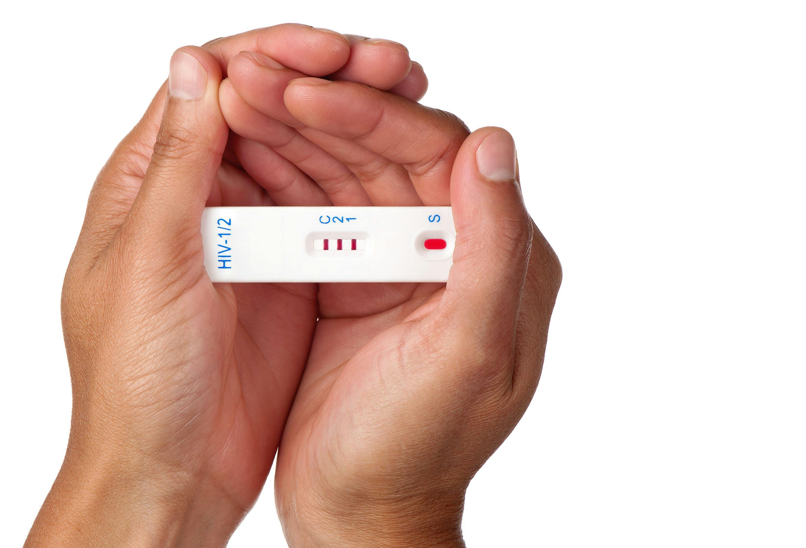 person holding HIV test
