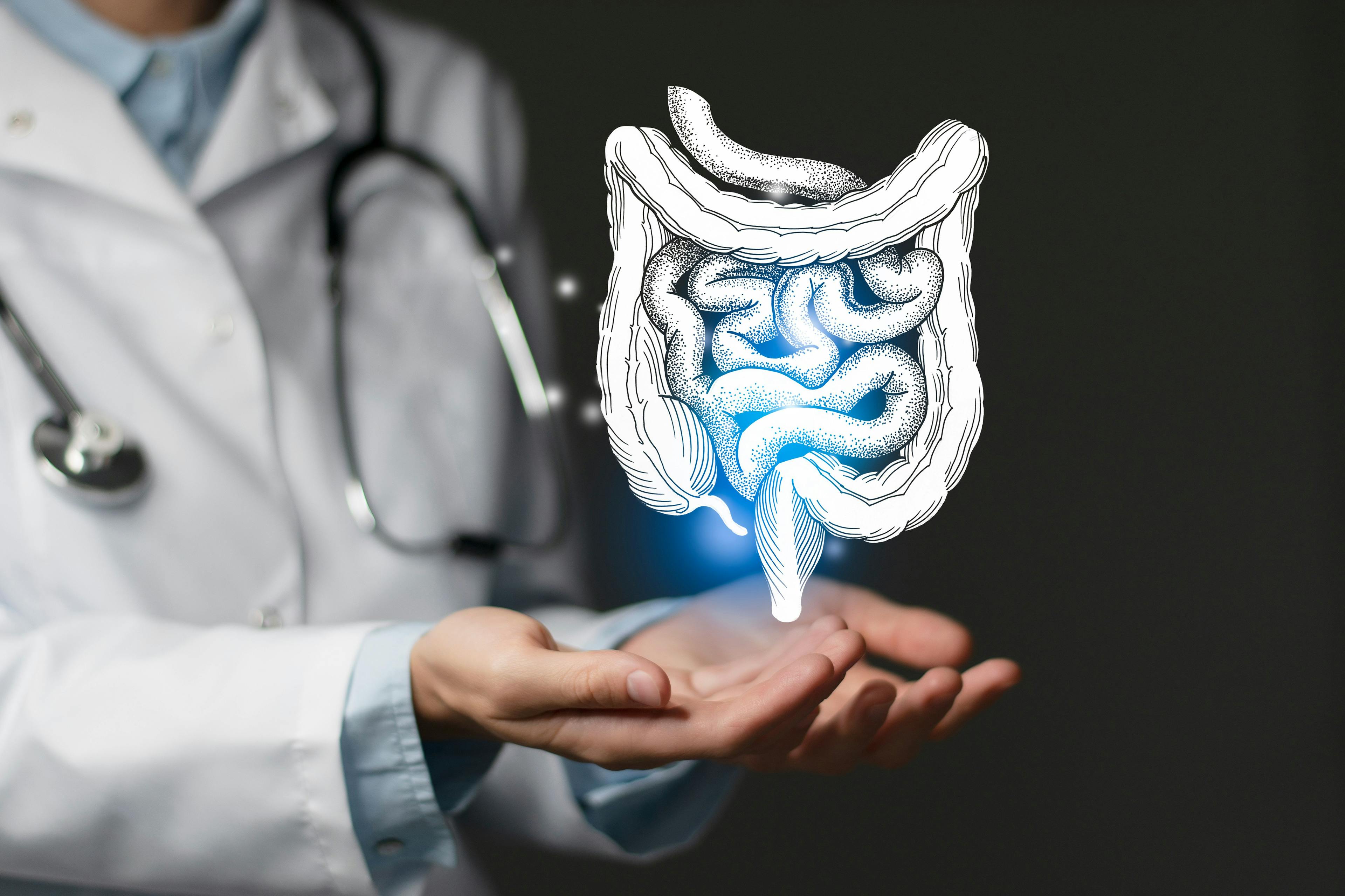 Doctor holding illustration of intestine | Image credit: mi_viri - stock.adobe.com