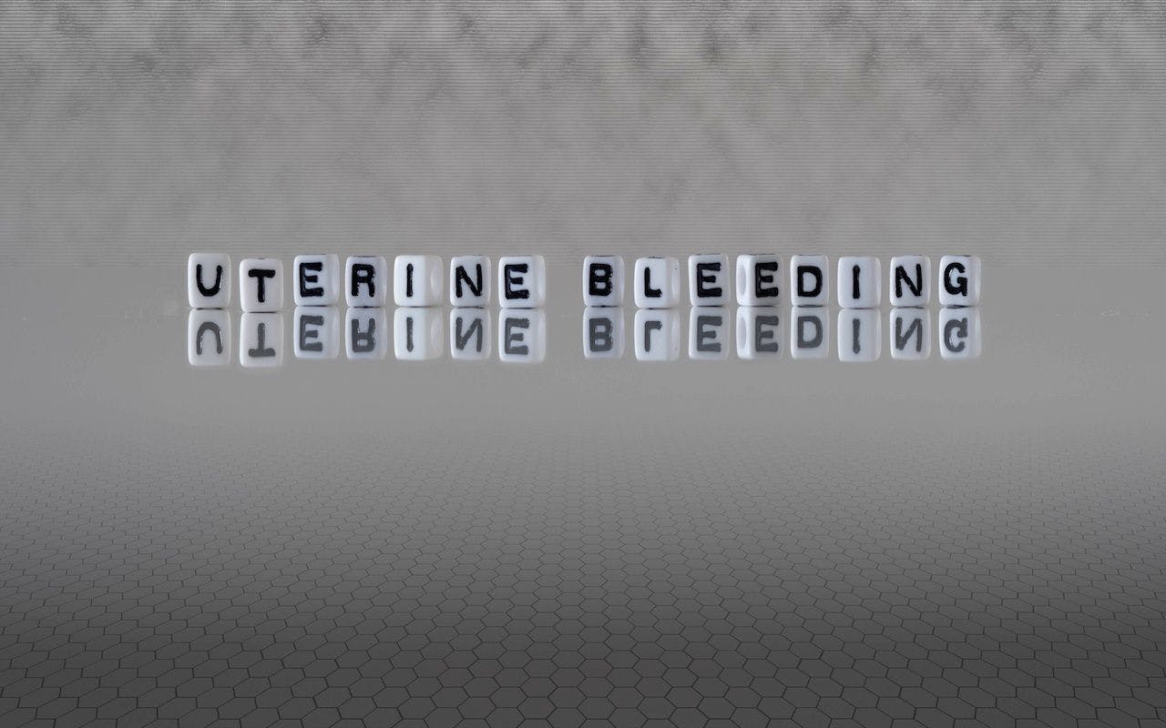 uterine bleeding word or concept represented by black and white letter cubes on a grey horizon background stretching to infinity: © lexiconimages - stock.adobe.com