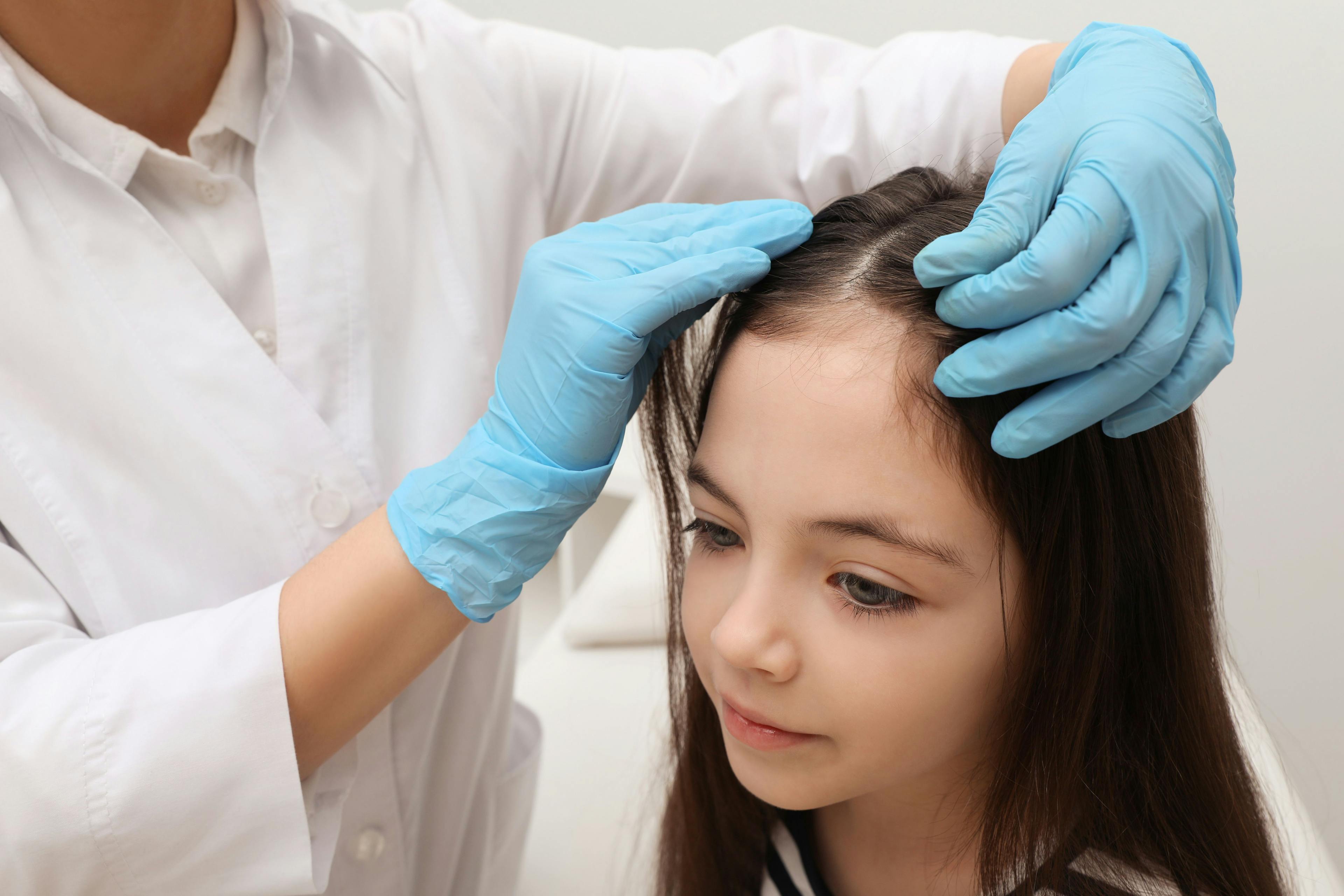 Doctor examining child's scalp | Image Credit: New Africa - stock.adobe.com
