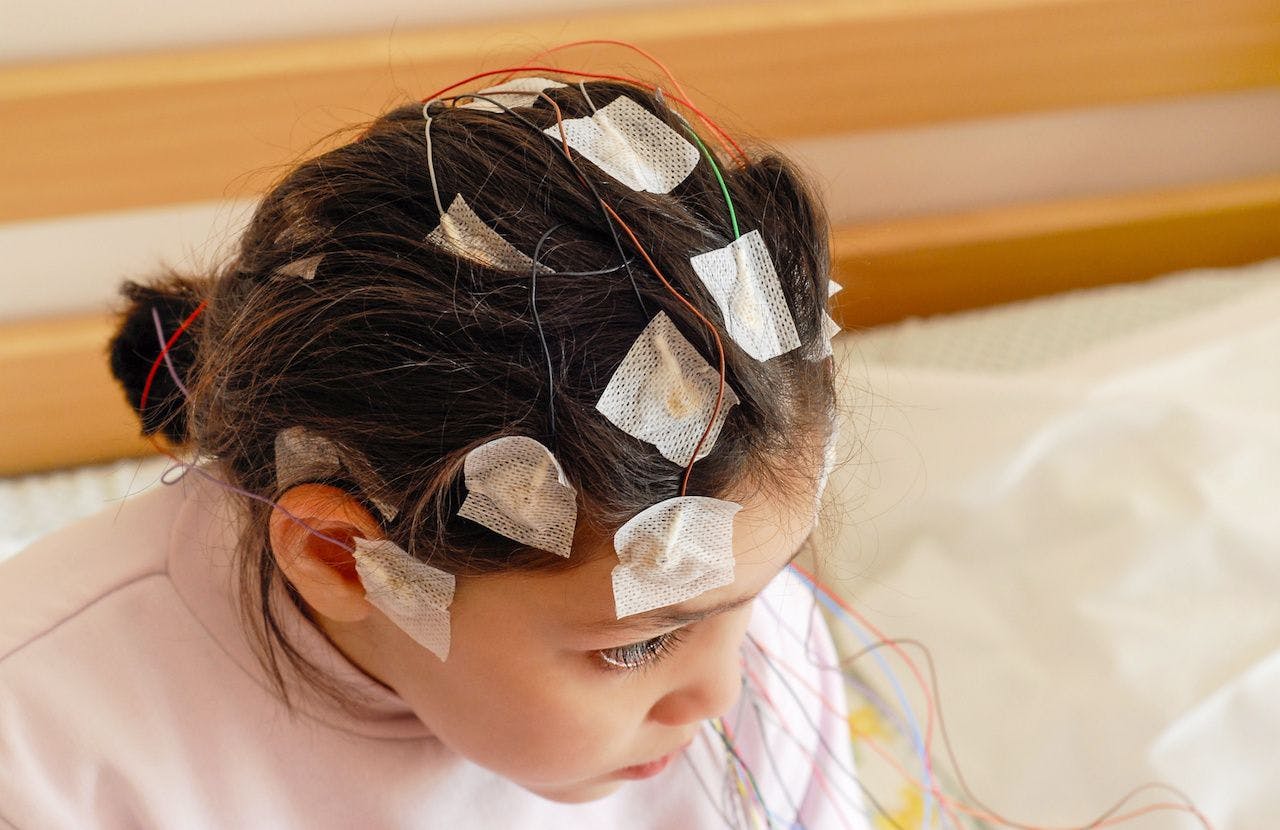 Girl with EEG electrodes attached to her head for medical test: luaeva - stock.adobe.com