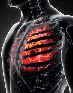 Risk of Cardiovascular Complications Is Higher for Patients With AF and COPD