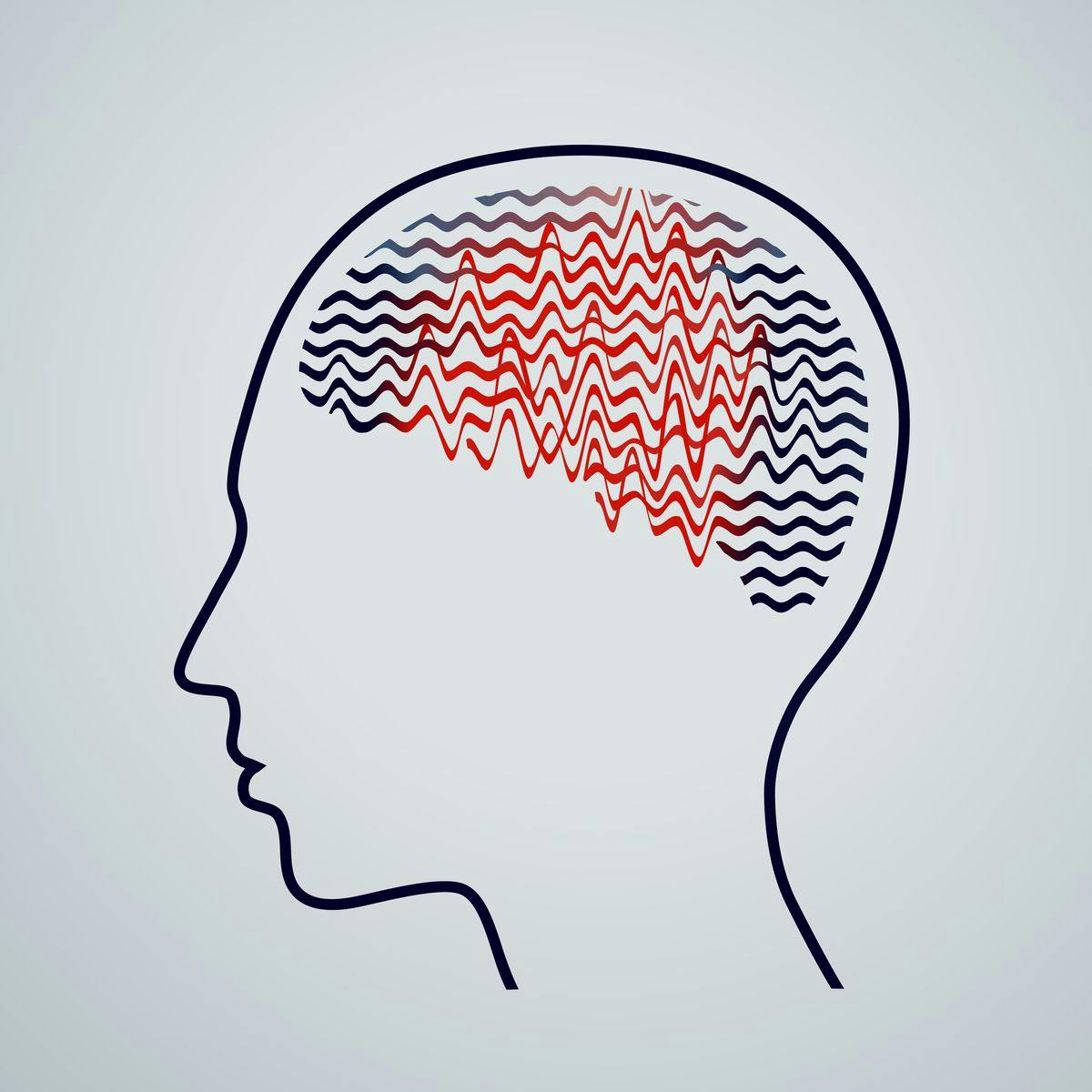 Human brain epilepsy activity